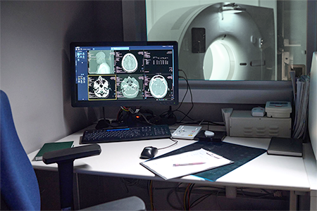 MRI Zone III Example