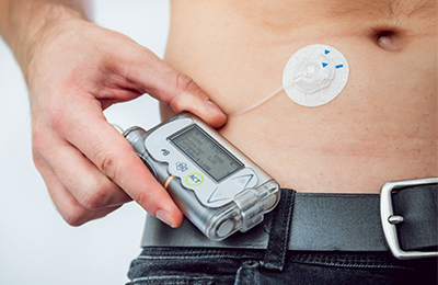 image of insulin pump