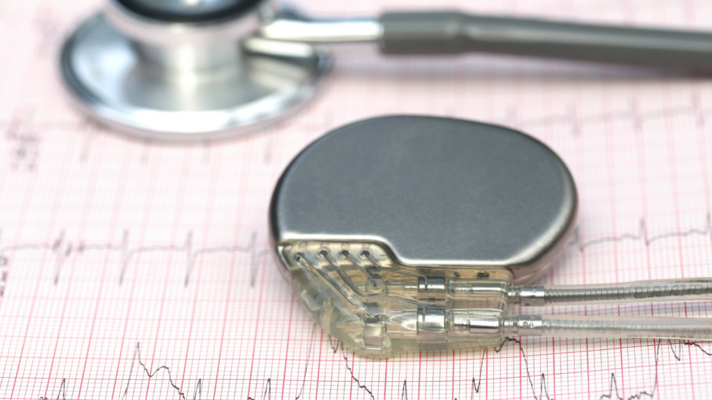MRI Safety for Patients With Implants: What You Need to Know
