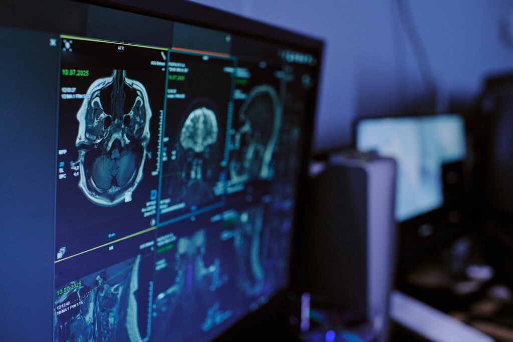 An angled view of a monitor with a brain scan in a darken room.