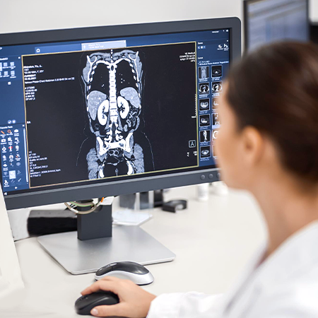 A female radiologist is studying the images of an abdominal scan.