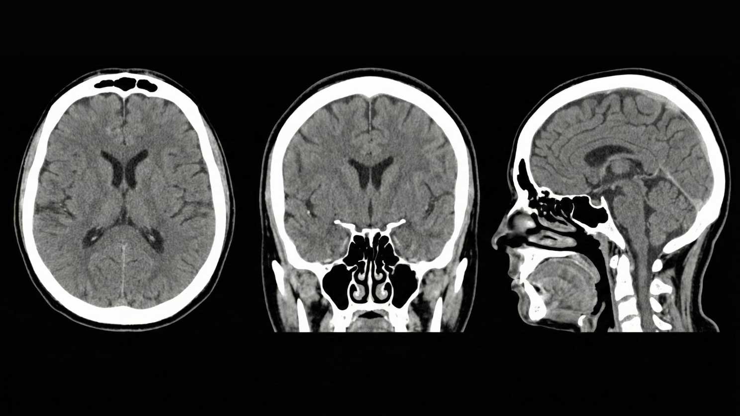 The History of MRI: From NMR to the Full-Body Scanner