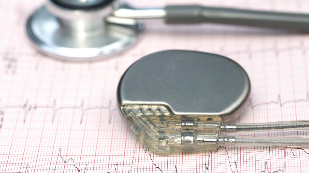 MRI Safety for Patients With Implants: What You Need to Know